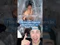 THIS MAN WAS FROZEN IN ICE FOR 3 DAYS AND SURVIVED!! #Shorts