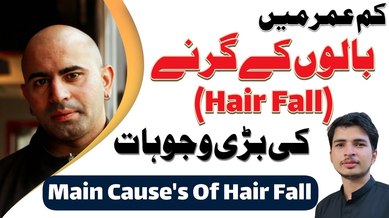 Hair Fall Ki Wajohat In Urdu | Main Cause's Of Hair Fall In Men | Med With Sajid