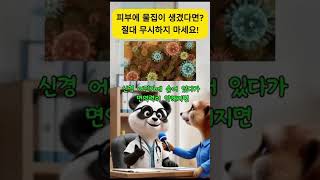 &quot;피부에 조그만 물집? 절대 무시하면 안 되는 병! 대상포진 초기증상과 예방법&quot;