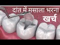 दांतों की कैविटी में मसाला भरना, खर्च Dat me Hole, dant me kide ka ilaj, Dental filling & Cost