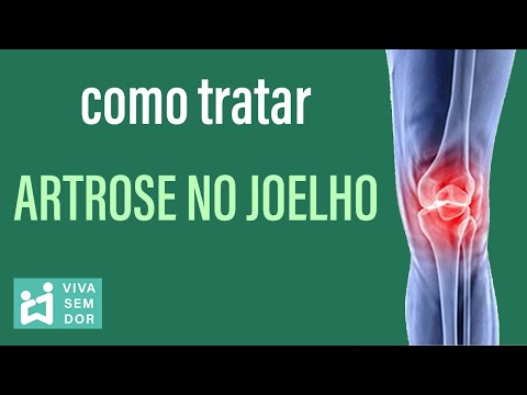 Vídeo: Joelhos Doloridos: Ajuda Para Osteoartrite