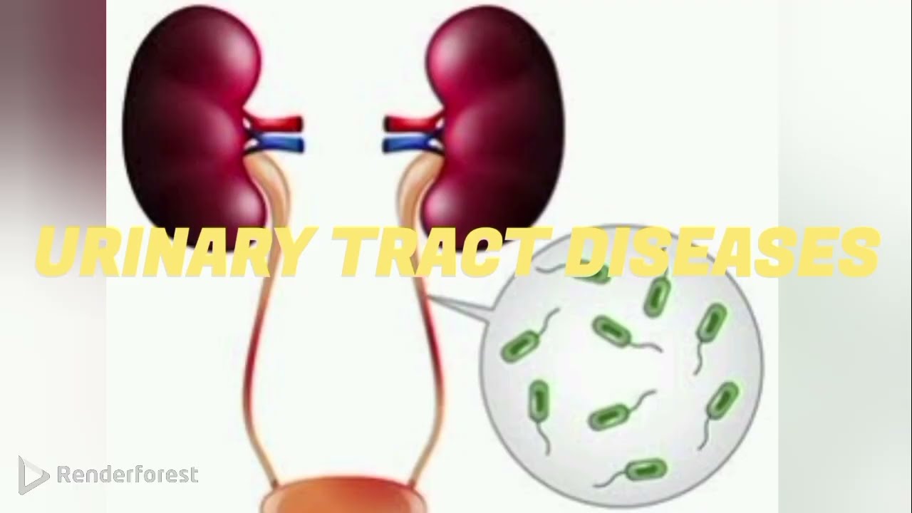 Urinary tract diseases, chapter 6, تمريض باطنة و جراحة الباب السادس كامل 