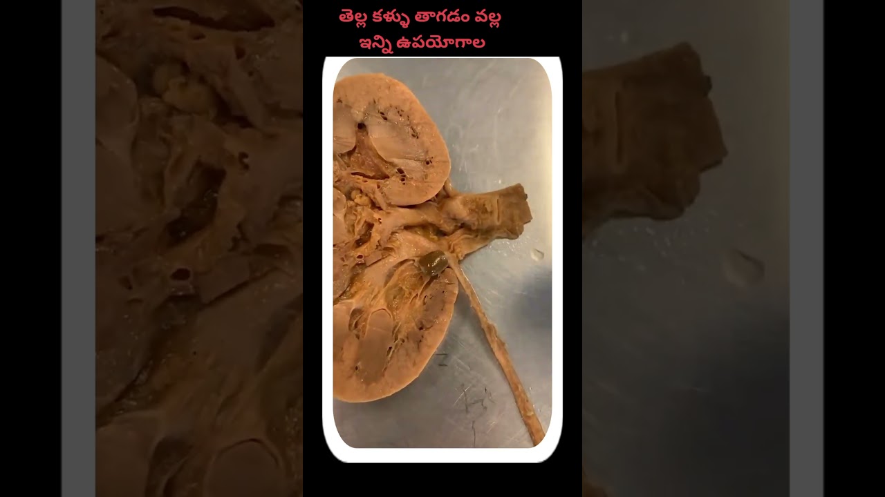 తెల్ల కల్లు తాగడం వల్ల ఇన్ని ఉపయోగాల 