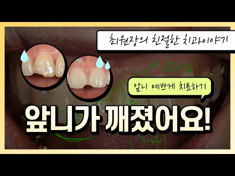 앞니가 깨졌을때 치료방법과 치아가 빠진경우 대처법에 대해 설명했습니다.