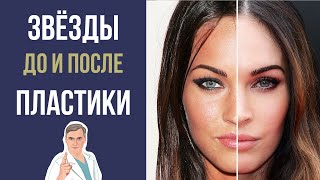 ЗВЕЗДЫ ДО И ПОСЛЕ ПЛАСТИКИ 🌟 ТОП-5 СЕЛЕБРИТИ