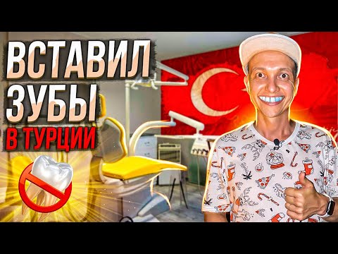 СКОЛЬКО СТОИТ СТОМАТОЛОГИЯ В ТУРЦИИ? ВСТАВИЛ ЗУБЫ В АНТАЛИИ! ЦЕНЫ ШОК! ТУРЦИЯ 2023