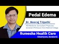 Know about pedal edema causes symptoms  treatment by consultant physician dr neeraj tripathi