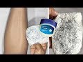 In 5 minutes remove unwanted hair permanently no shave no wax painlessly remove unwanted hair