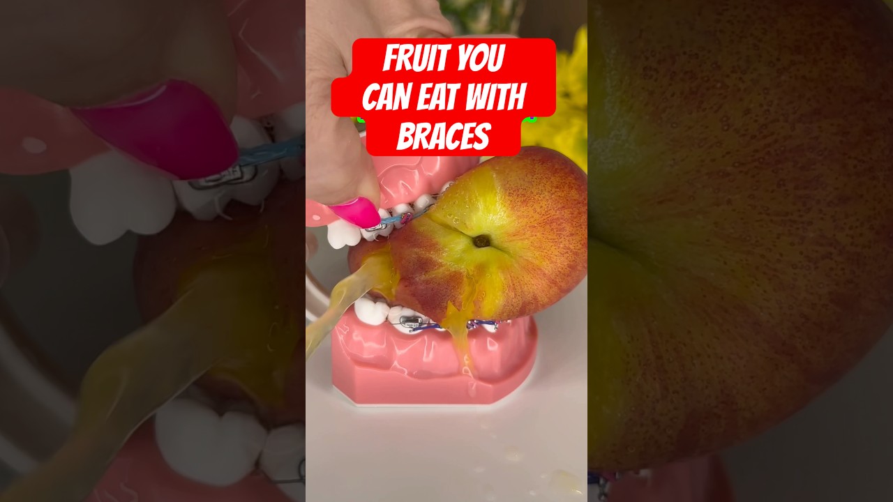 FRUIT YOU CAN EAT WITH BRACES 🍊 