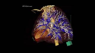 Cardiac CT Course Dubai - Introduction to SYNAPSE 3D Cardica 4D Viewer