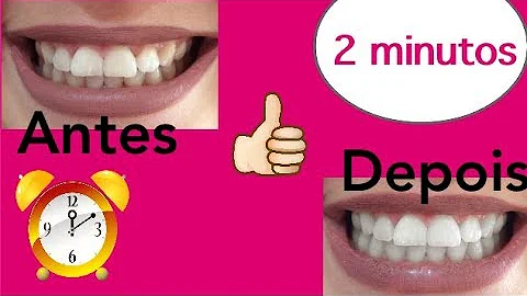 Que que é bom para tirar tártaro do dente?