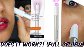 Testing Light Therapy for ACNE, Is It Worth It? Does It Really Work? - YouTube