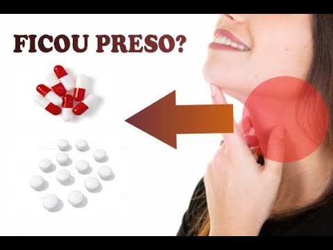 Vídeo: Um comprimido se dissolve na sua traqueia?