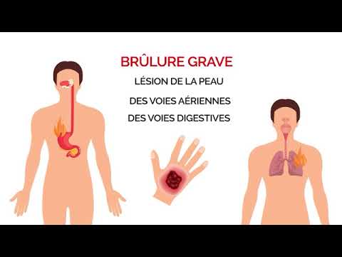 Conduite à Tenir - face à une plaie ou des brûlures