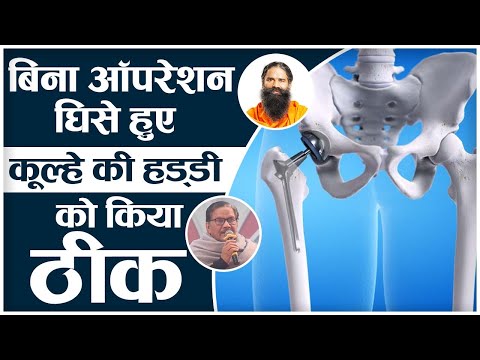 बिना ऑपरेशन घिसे हुए कूल्हे की हड्‌डी को किया ठीक  || Swami Ramdev