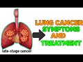 LUNG CANCER SYMPTOMS|LUNG CANCER TREATMENT