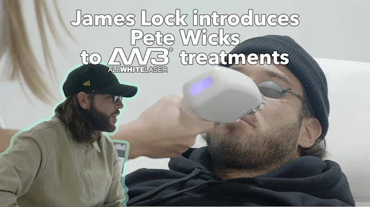 James Lock & Pete Wicks with AW3 Laser