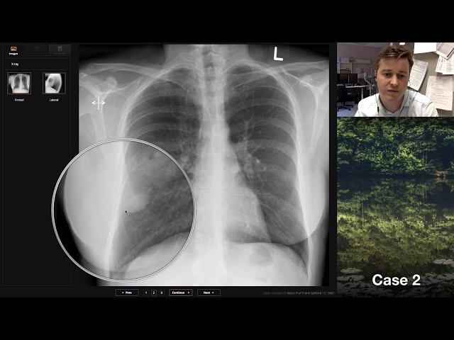Isolation tutorial: Chest x-ray with Andrew Dixon - YouTube