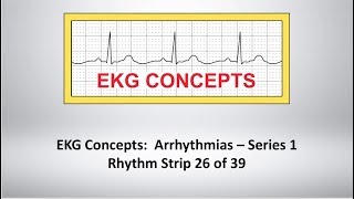 EKG Concepts: Arrhythmias Course - Strip 26 of 39