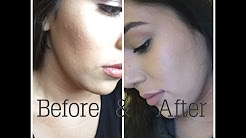 How I got rid of tiny face bumps + Current skin care routine