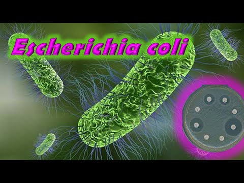 Vídeo: Identificación Y Perfil De Susceptibilidad Antimicrobiana De Escherichia Coli Aislada De Pollo De Traspatio En Y Alrededor De Ambo, Etiopía Central