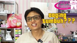 daging tumbuh di gigi part 1