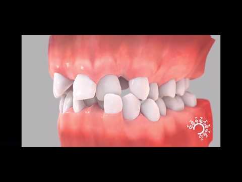 Vidéo: Perceptions Et Pratiques Des Médecins Généralistes Concernant La Prestation De Soins De Santé Bucco-dentaire Aux Personnes Atteintes De Diabète - Une étude Qualitative