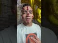 المرض الجديد مرض العنب المرض الجديد مرض العنب