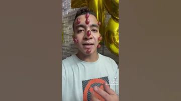 المرض الجديد مرض العنب 