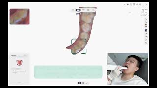 CEDU OScan Intraoral Scanner | Complete Scanning Tutorial