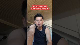 Tuz Kullanımı Böbreğe Zarar Veriyor Resimi