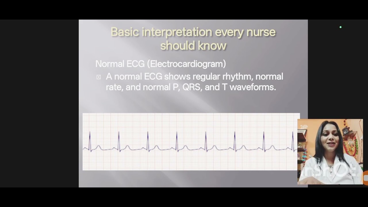 ECG (Basic interpretation)
