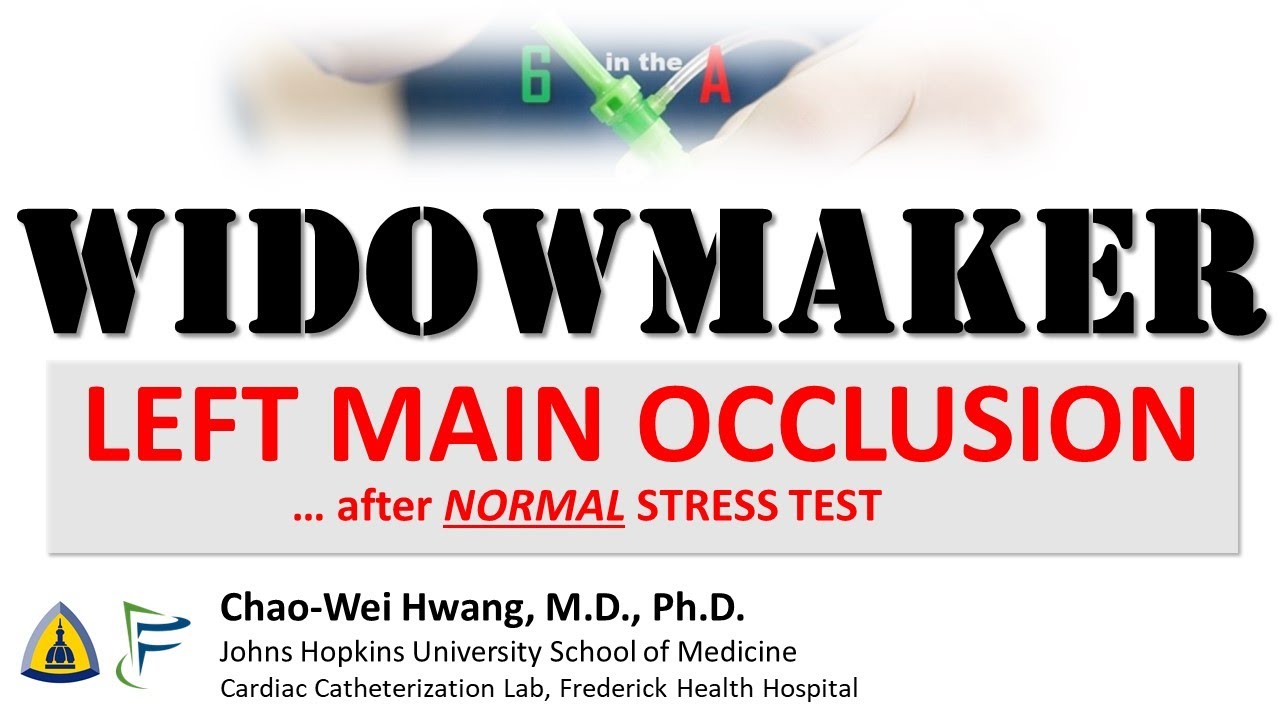 Widowmaker Heart Attack: Left main occlusion after normal stress test