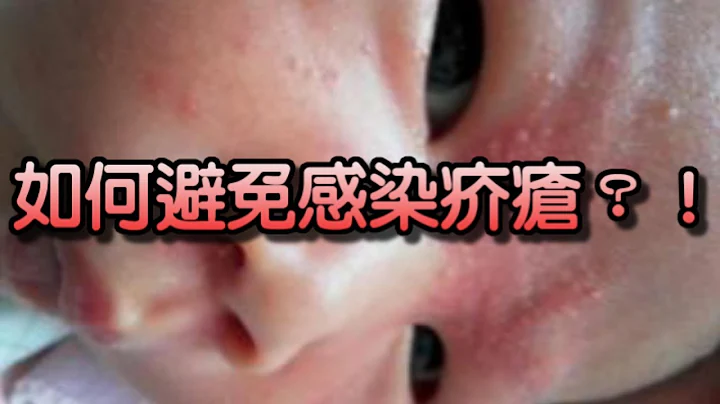 如何避免感染疥瘡？！ - 天天要聞
