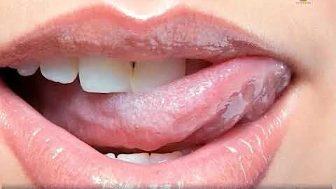 Դեկտեմբերի 1 ը ՁԻԱՀ ի դեմ պայքարի համաշխարհային օրն է