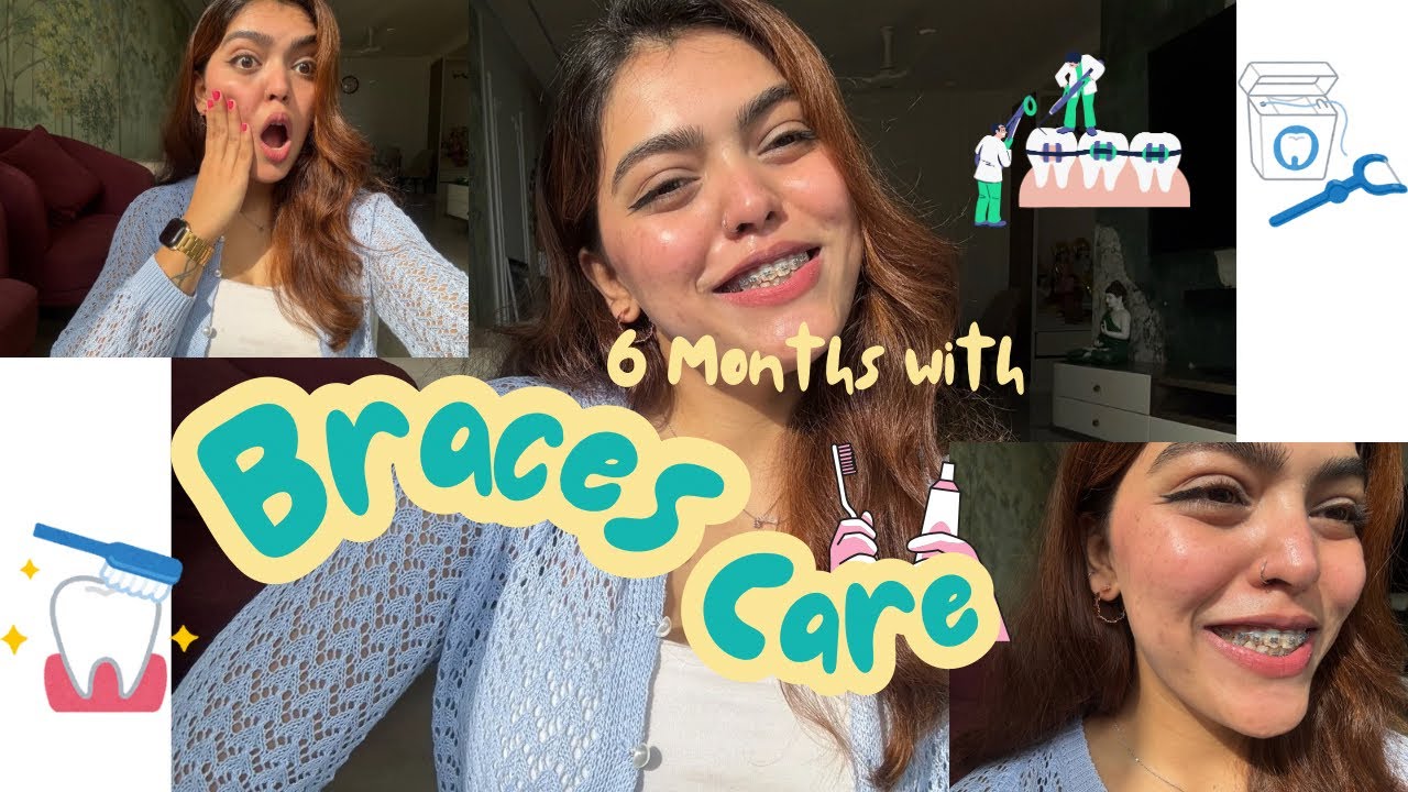 TIPS🦷Do’s and Don’t while *BRACES*on🪥 