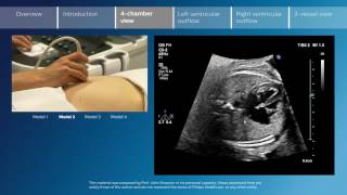 Key screening views of the fetal heart - Part 3 - 4-chamber view Resimi