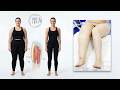 Tampa Lipedema Liposuction 🌟 Dr. Kardashian Removes 90% Fat | Cankles & Knees | 360° Awake Surgery 💪