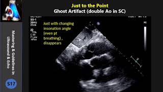 Ghost Artifact (double Ao in SC)