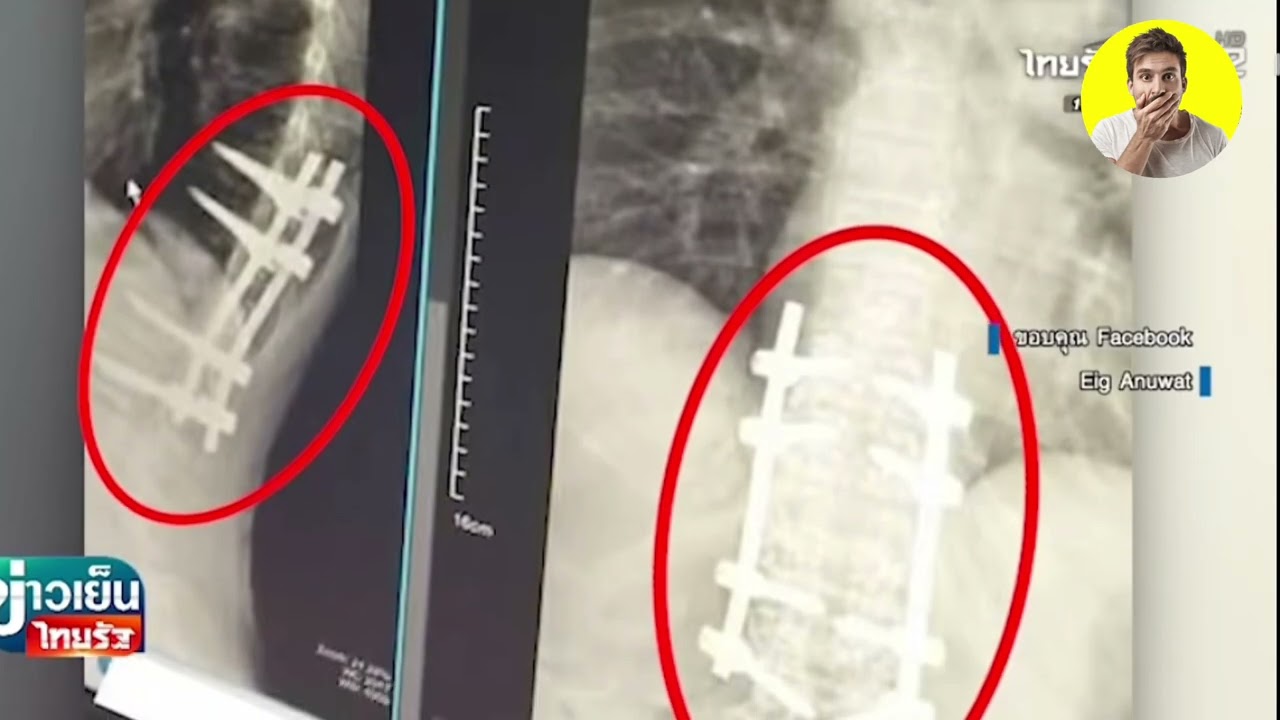 တစ်ချို့ ထိုင်းအလုပ်ရှင်တွေဟာ တောတော်လေးကို ကိုယ်ချင်းစားစိတ် မရှိကြဘူး