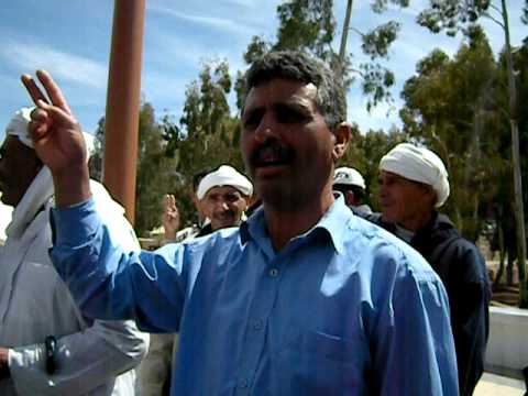 السيليكوز داير حالة