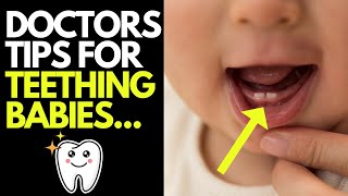 Doctor explains key things you need to know about BABY TEETHING | Symptoms & tips for managing it! screenshot 5