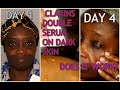 I USED CLARINS DOUBLE SERUM FOR 4 DAYS AND SEE WHAT HAPPENED (WORTH THE HYPE?) #wishfulskinthirstrap