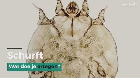 Wat moet je doen als je schurft hebt
