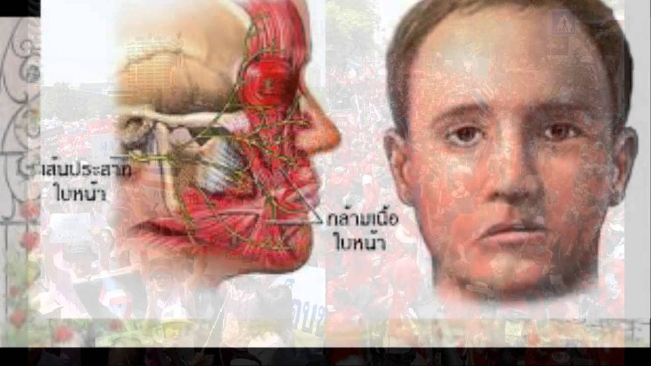 Прозопалгия Что Это Такое Фото