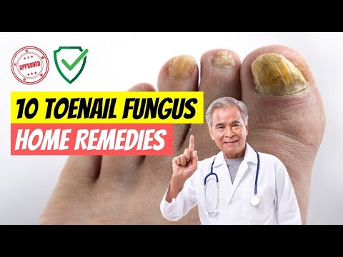 Try One of These 10 Home Remedies for Toenail Fungus