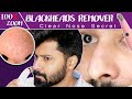 BLACKHEADS removing MACHINE | 100 % Working | Tamil | Not sponsored | shadhik azeez