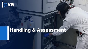 Handling & Assessment Of Human Primary Prostate Organoid Culture l Protocol Preview