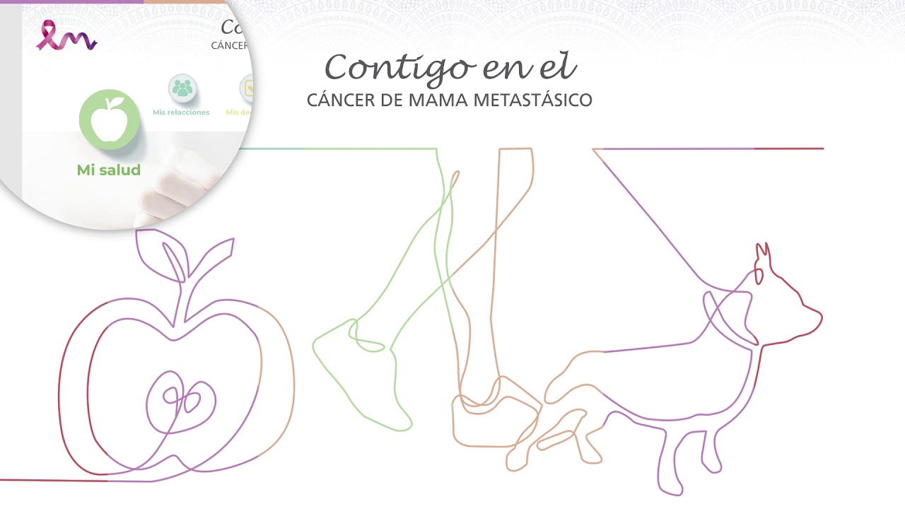 españa nueva Contigo en el cáncer de mama metastásico