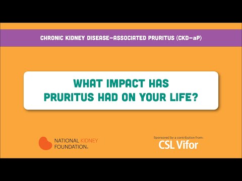 What impact has